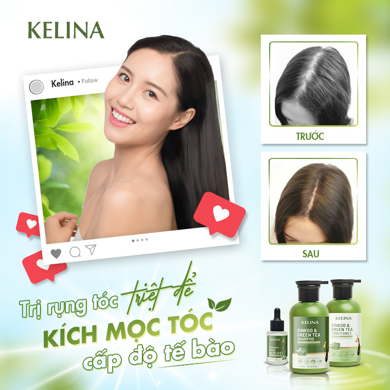 Combo Dầu Gội, Xả 300ml Và Serum 30ml Hỗ Trợ Kích Mọc Tóc, Ngăn Ngừa Rụng Tóc Và Phục Hồi Tóc Hư Tổn Kelina