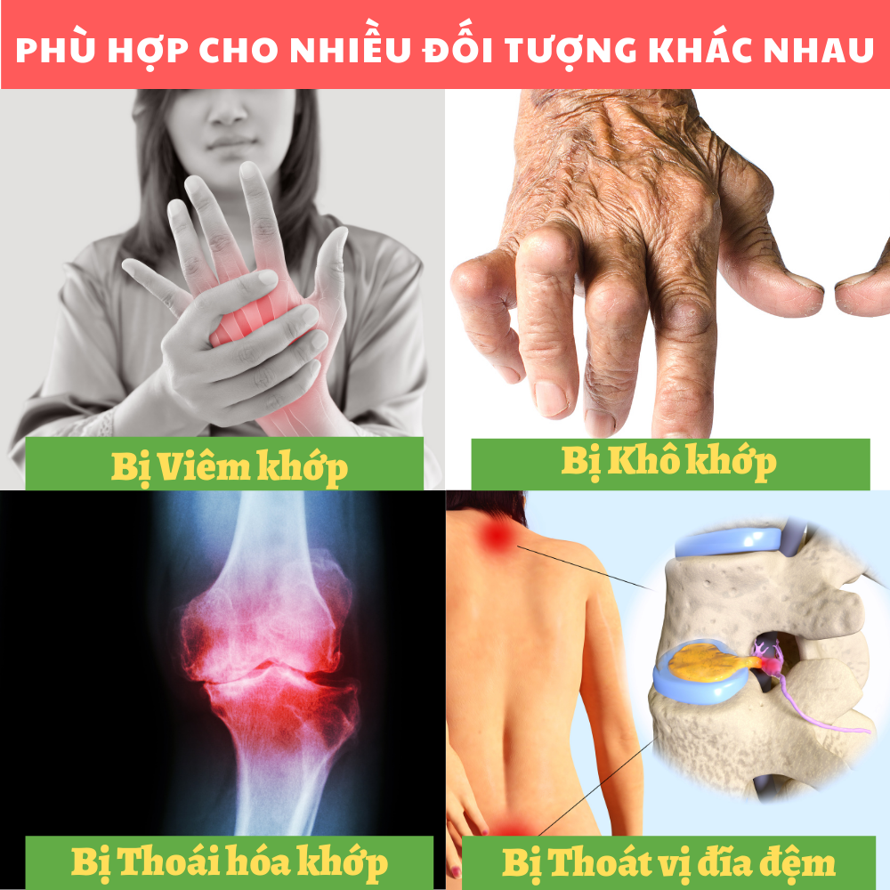 Toxmin Flex - Viên Uống bổ xương khớp, Giúp dưỡng khớp, Chống viêm, Giảm đau nhức khớp, Giảm thoái hóa khớp
