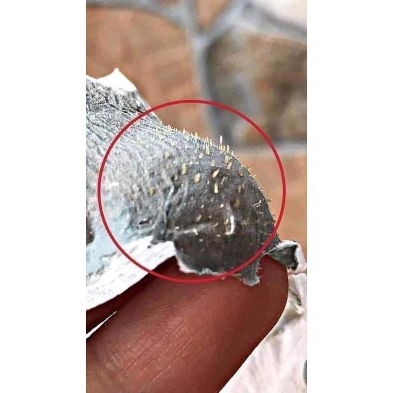 10 tuyp lột mụn ance