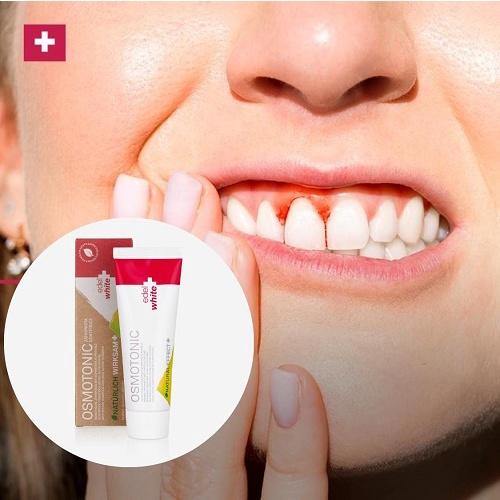 Kem đánh răng Osmotonic Thụy sĩ - hết chứng viêm đau, chảy máu lợi