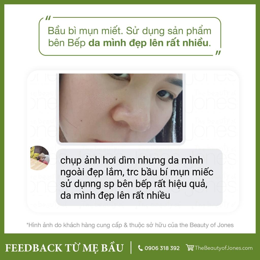 Mặt nạ than tre ngừa mụn an toàn cho mẹ bầu The Beauty of Jones 50gr