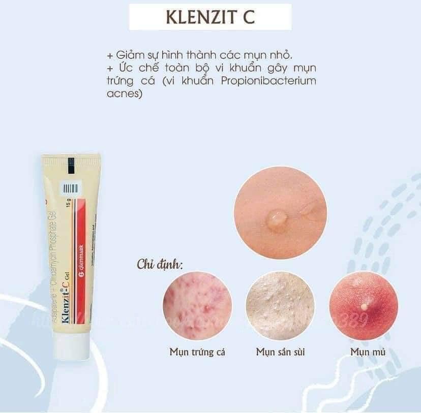 Gel Bôi Mụn Viên,Mụn Ẩn KLENZIT C Tuýp 15g