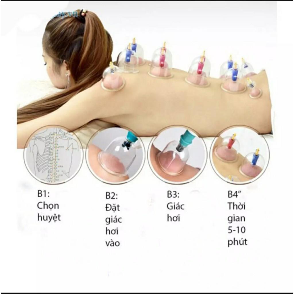 Bộ Giác Hơi Không Cần Lửa 12 Ly Kèm 1 Ống Bơm Chuyên Dụng