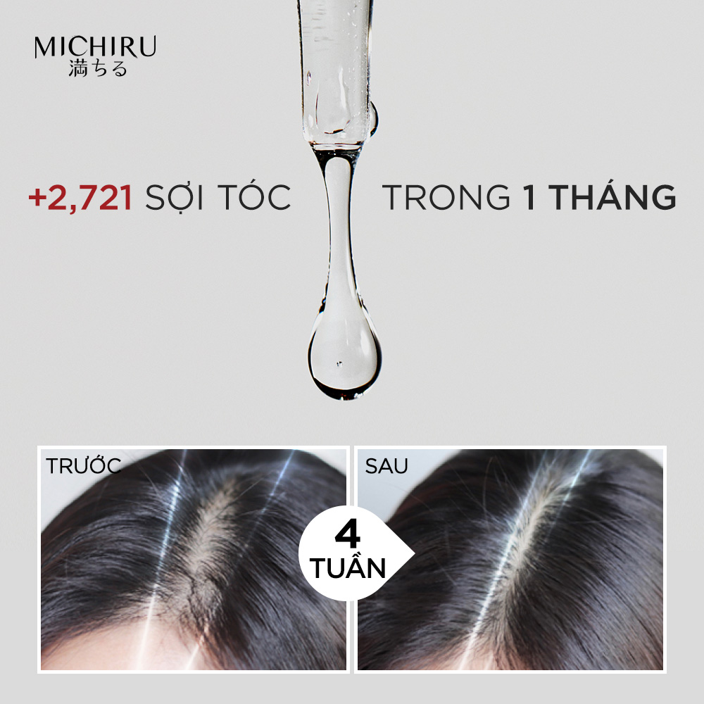 Tinh Chất Serum Michiru Giúp Mọc 2,721 Sợi Tóc Sau 1 Tháng Với Hoạt Chất Dynazinc 45ml