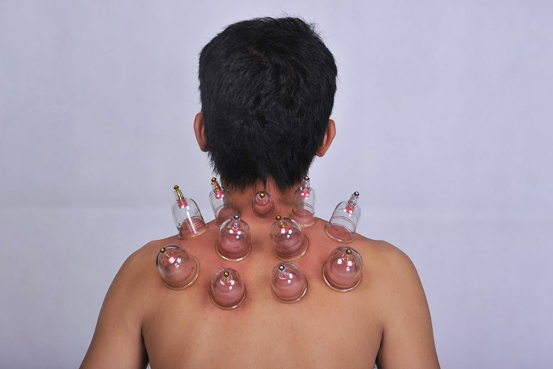 Bộ Giác Hơi Không Dùng Lửa Duy Thành YGH05