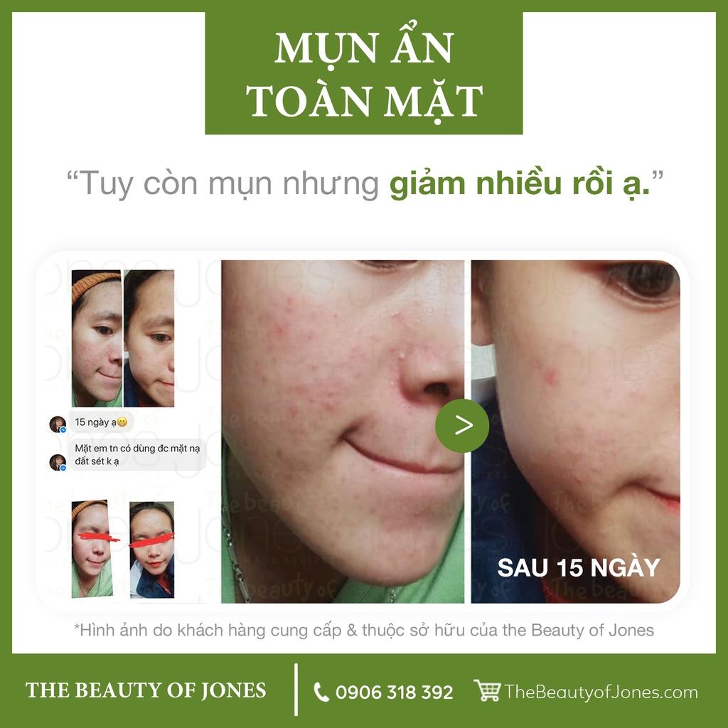 Bộ đôi làm sạch và chống nắng cho da mẹ bầu The Beauty of Jones