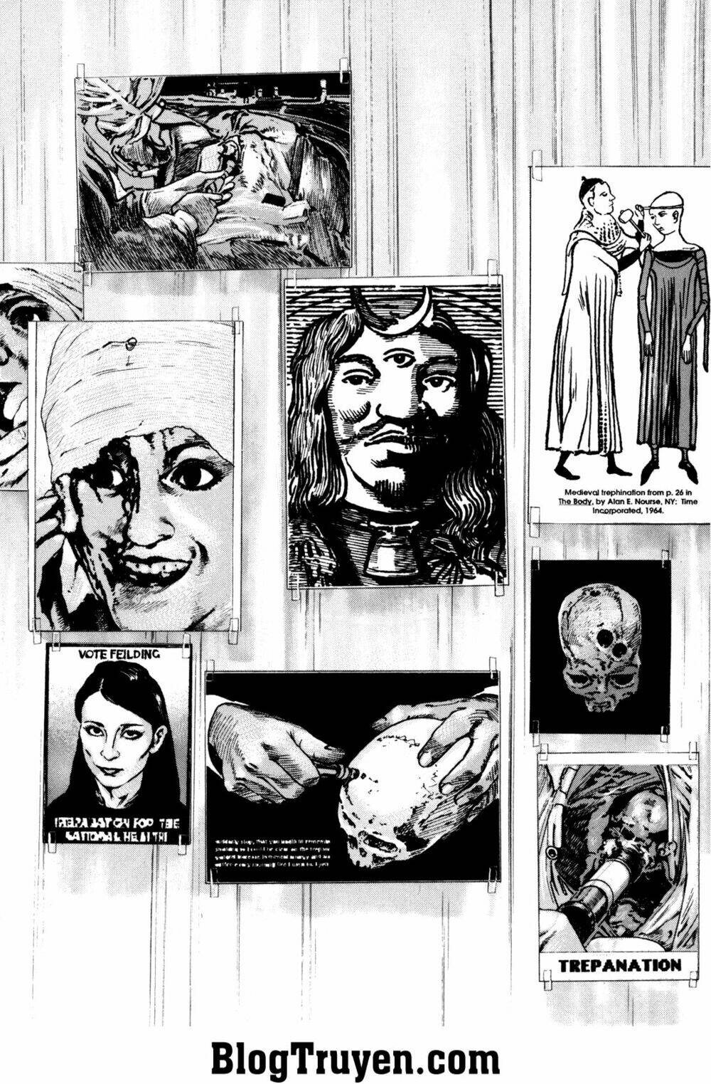 homunculus chapter 104 10