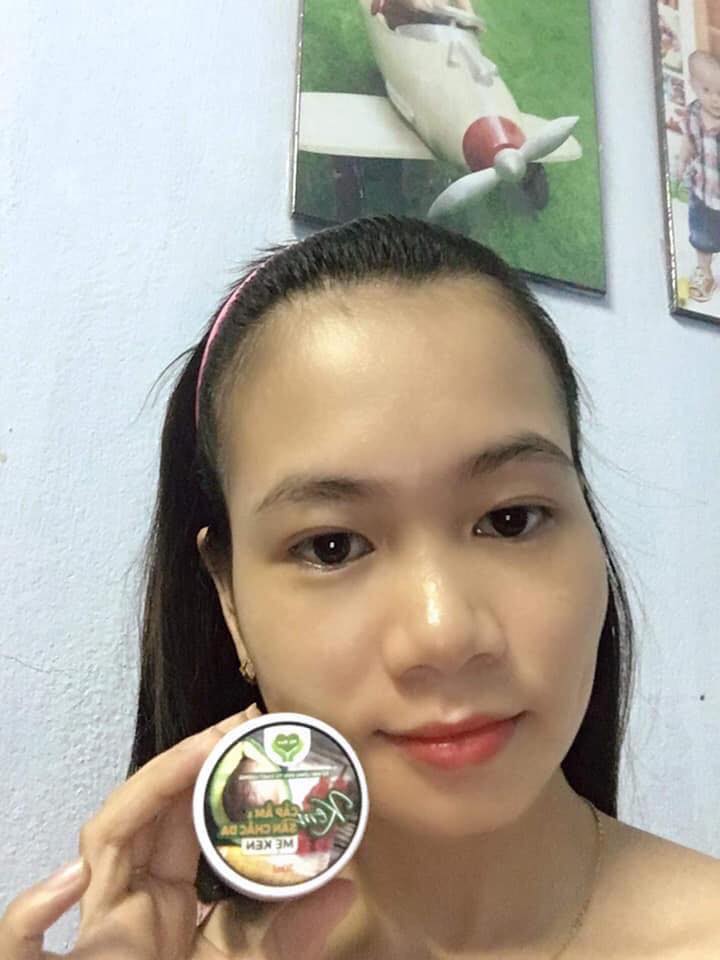 KEM CẤP ẨM VÀ  SĂN CHẮC DA MẸ KEN (30ml)