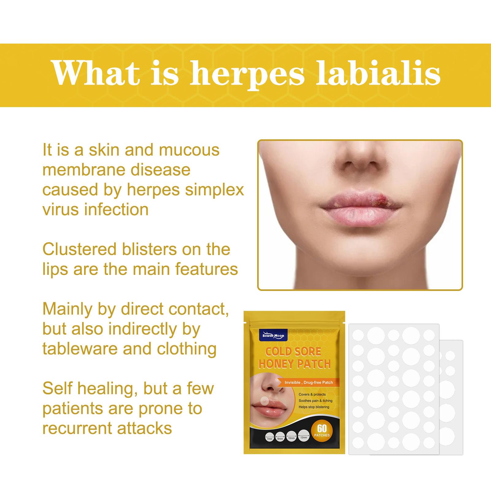 South Moon 60 patches Cold Sore Honey Patch Blister Treatment Conceals Protects Soothes & Hides Cold Sores