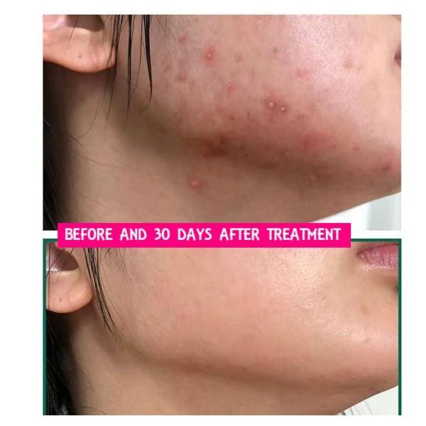 Nước hoa hồng Làm Dịu Da Mụn, Cấp Ẩm Dưỡng Sáng Da COSRX AHA/BHA CLARIFYING TREATMENT TONER 50ml/100ml