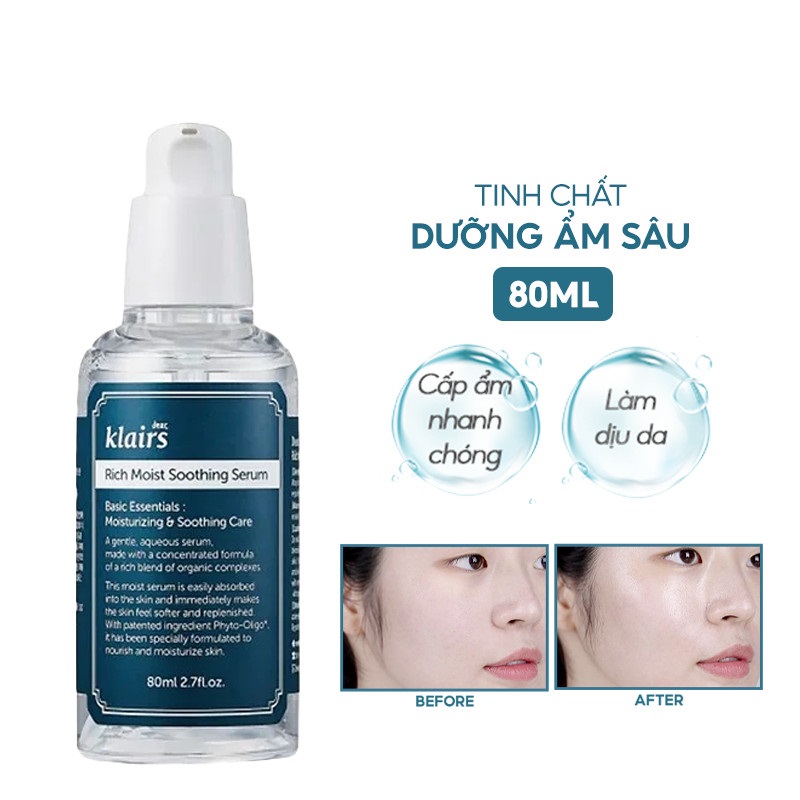 Combo 2 Sản Phẩm Cấp Ẩm, Làm Dịu Da Dear, Klairs Rich Moist Soothing (Serum 80ml + Kem 80ml)