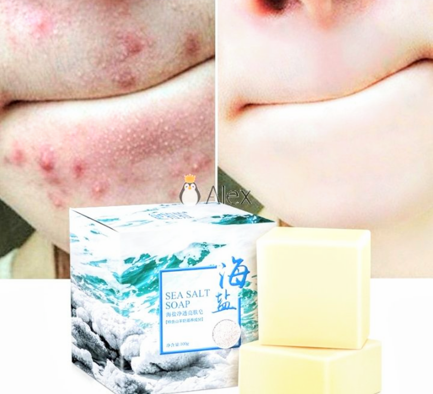 1 BÁNH XÀ PHÒNG TẮM RỬA MẶT MUỐI BIỂN TRỊ MỤN HIỆU QUẢ CAO LOẠI TỐT