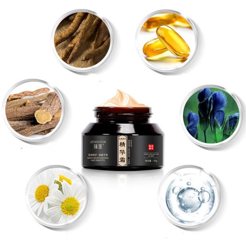 Kem xoá sẹo làm mờ vết rạn da thâm lồi, bỏng, thủy đậu , vết thâm mặt cải thiện làn da sáng mịn