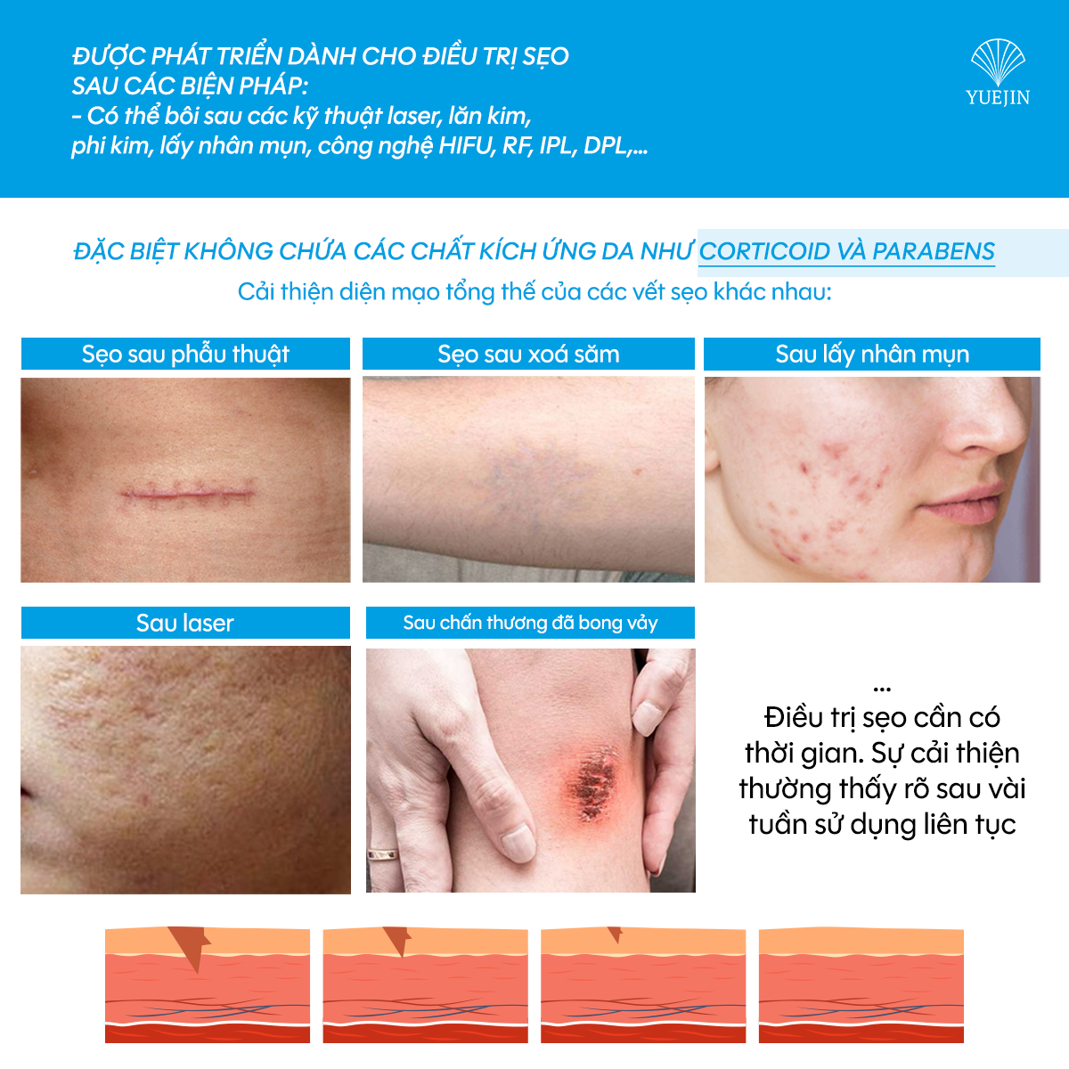 Gel trị sẹo GK SCAR GEL lấp đầy Sẹo Rỗ, Sẹo Lõm, làm phẳng Sẹo Lồi, Sẹo Thâm 15ml của Yuejin