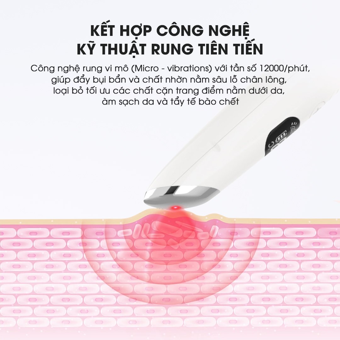 Máy Massage Mắt Giảm Nếp Nhăn, Quầng Thâm, Bọng Mắt JOOU XE19 - Công nghệ Ánh sáng Xanh/Đỏ - 5 chế độ Massage - Rung vi mô 12000rpm - Công nghệ Nhật Bản