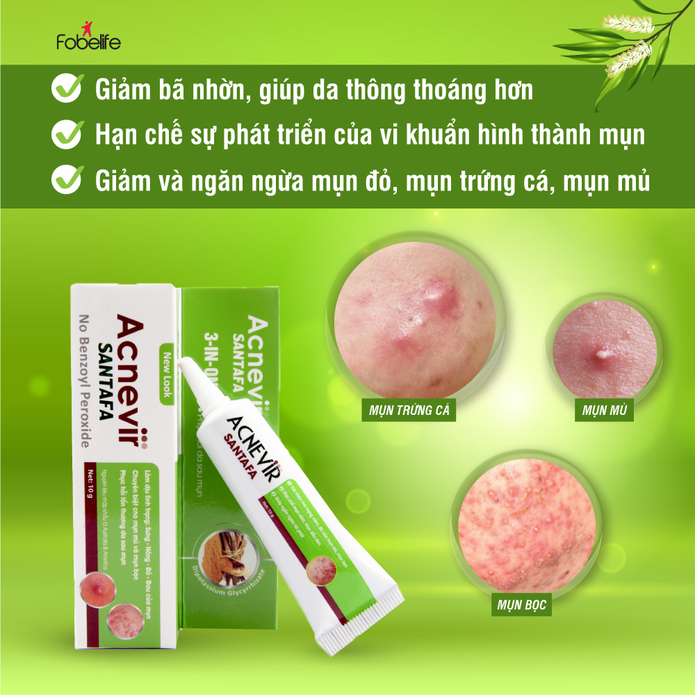 Hình ảnh Kem Hỗ Trợ Giảm Mụn Mủ Mụn Viêm Mụn Bọc Acnevir Santafa xanh ( Tuýp 10gr )