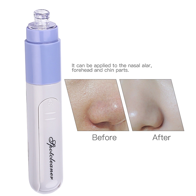 ROGTZ Máy Hút Mụn Mini Pore Cleaner Nhỏ Gọn Cao Cấp - Hàng Nhập Khẩu