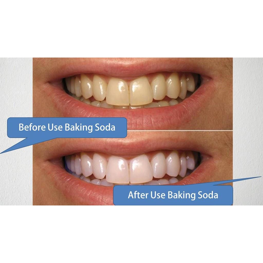 Baking Soda trắng răng ️CHÍNH HÃNG Backing soda Làm sạch răng miệng, Banking soda khử độc thực phẩm