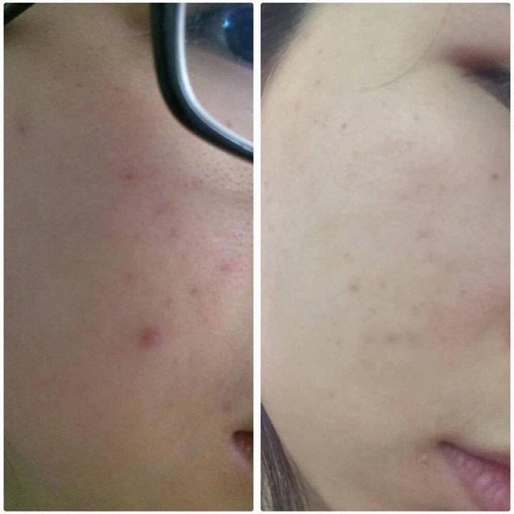 Serum siêu cấp ẩm sáng da dành cho mẹ bầu The Beauty of Jones 30ml, Sữa rửa mặt sample 20gr