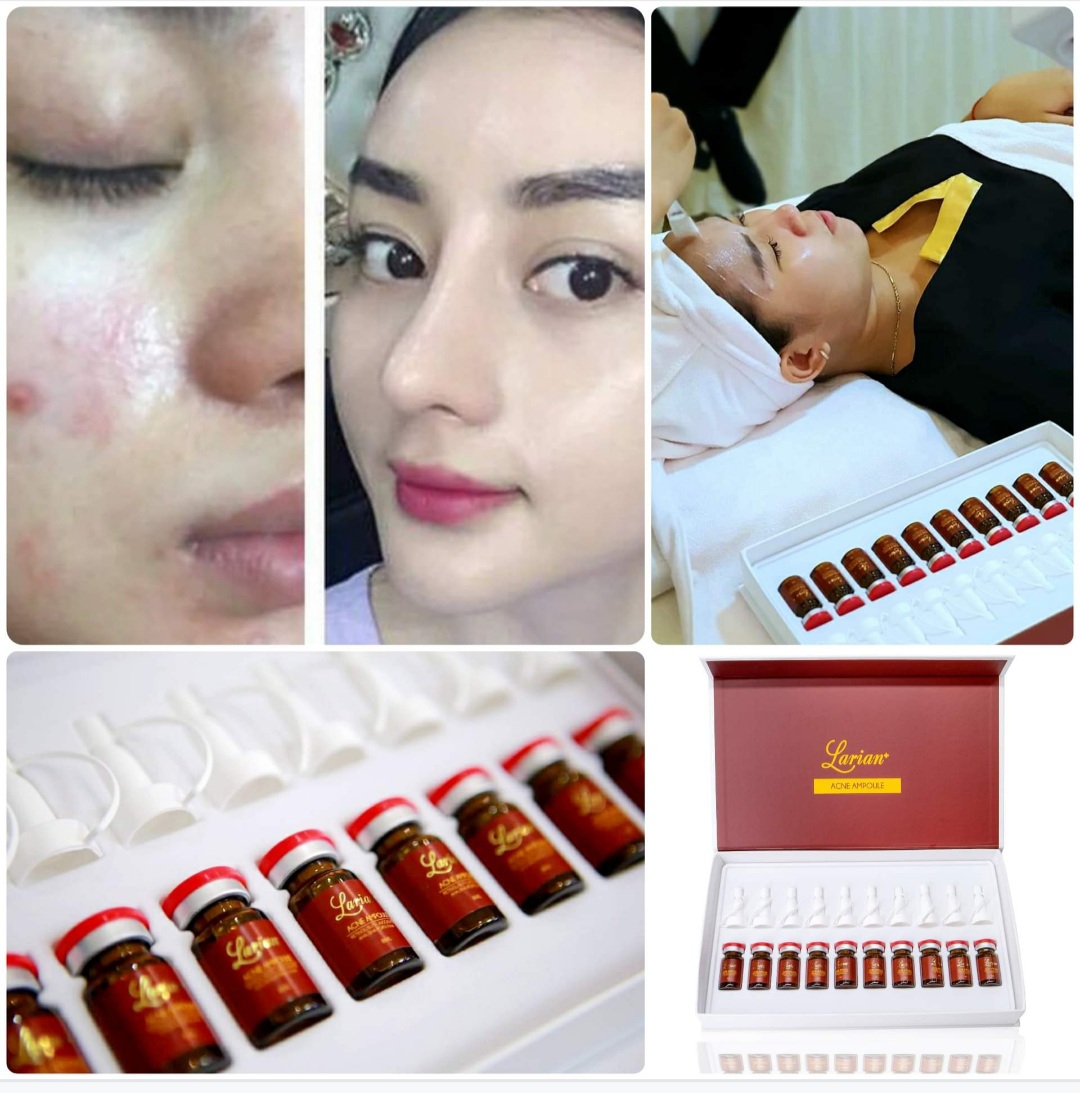 Tế bào gốc trị mụn Dna Cá Hồi Larian Acne Ampoupe dành cho Spa trong liệu trình trị liệu chuyên sâu cho da mụn