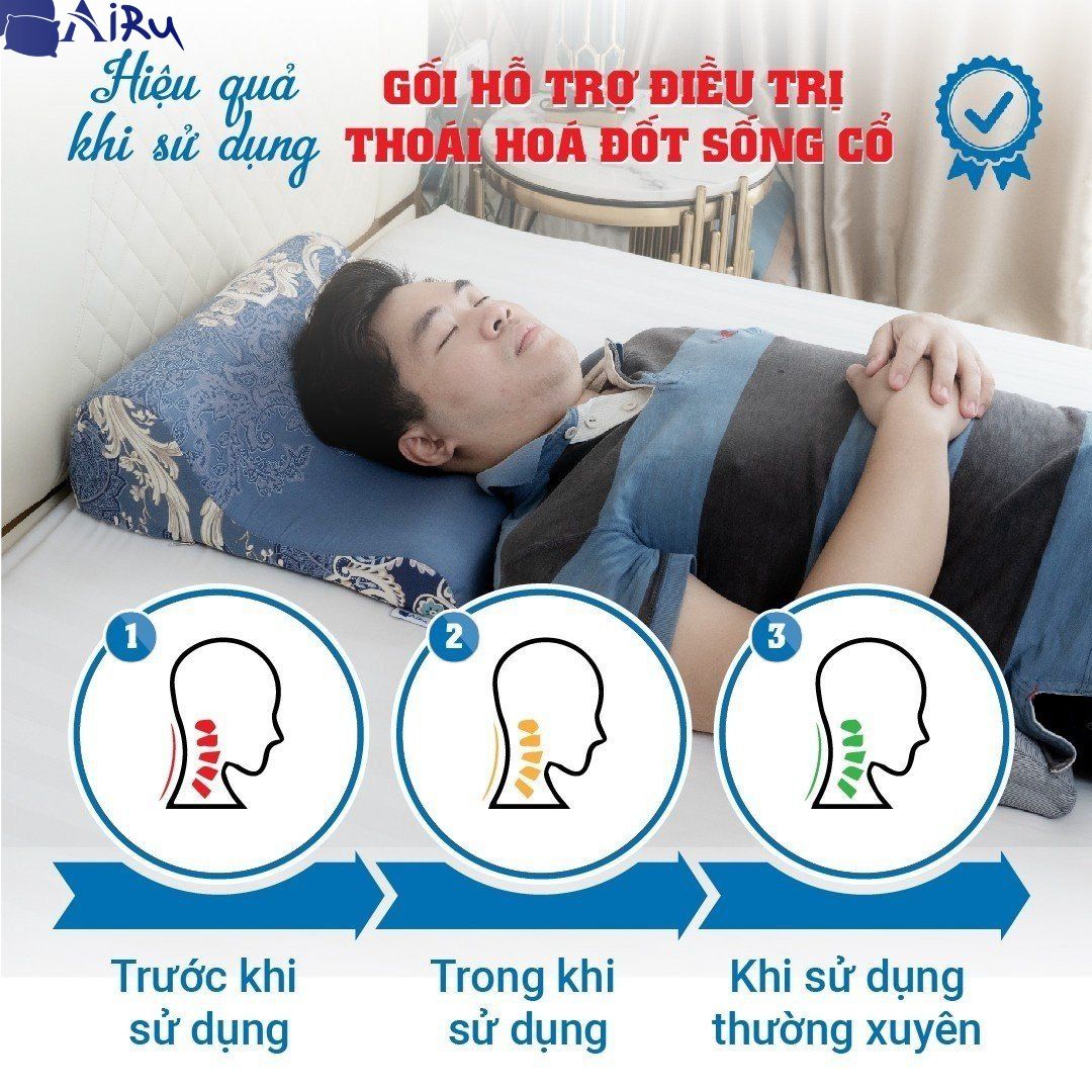 Gối chống thoái hóa cột sống cổ- AIRU giúp giảm đau mỏi cổ vai gáy, giúp máu lưu thông tốt lên não, giúp ngủ ngon và sâu hơn