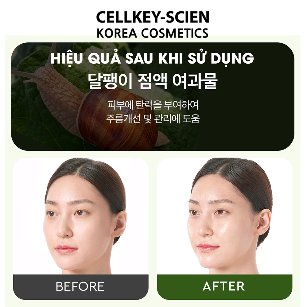 Tinh Chất Ốc Sên Phục Hồi Dưỡng Ẩm Trắng Da Chống Nhăn Ngăn Ngừa Lão Hóa Dewytree Ultra Vitalizing Snail Serum 70ml