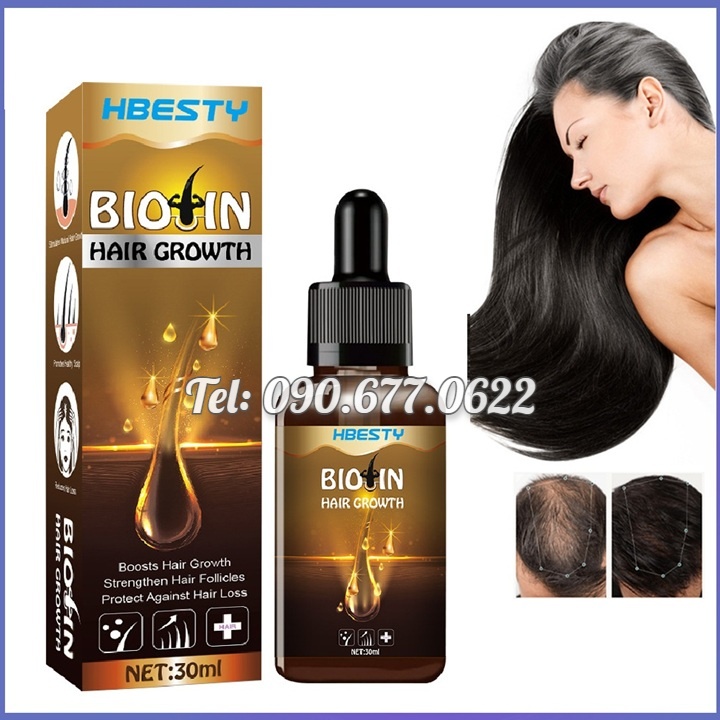 Chai xịt dưỡng kích mọc tóc, giúp tóc mọc dài nhiều và dày, mọc tóc nhanh, bóng, mượt, ngăn rụng tóc xuất xứ Singapore - Mã số 1102