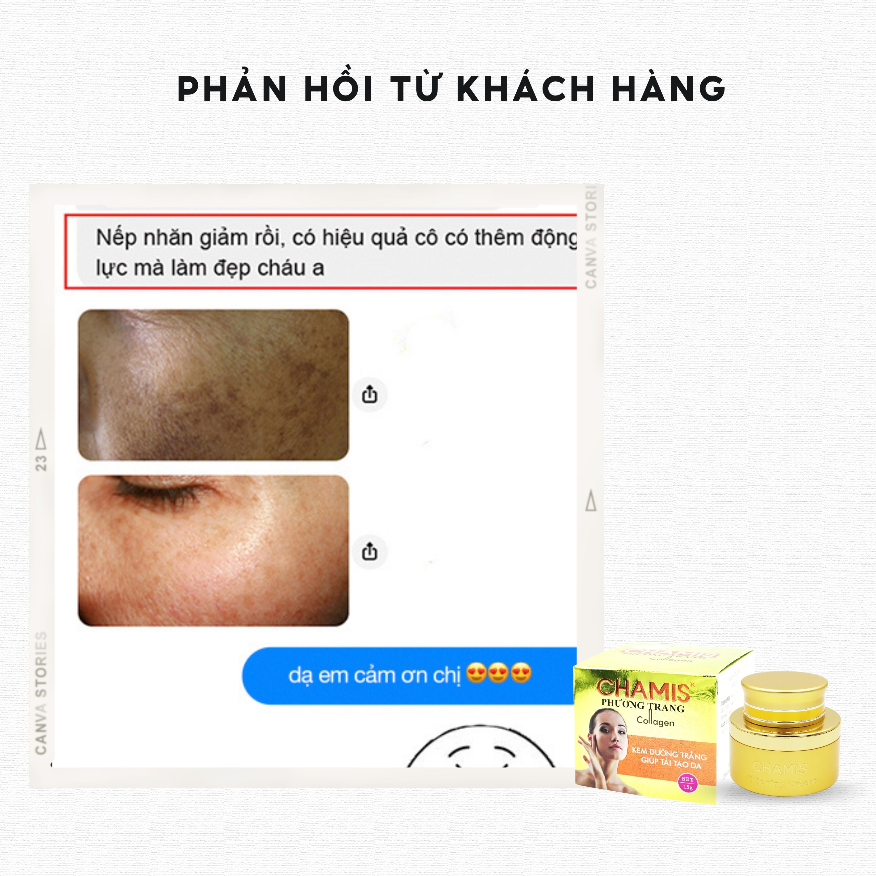 Kem dưỡng trắng, tăng sinh collagen tái tạo làn da săn chắc, sáng mịn Chamis