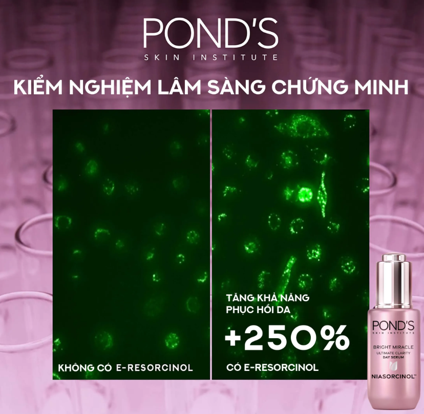 Combo Serum Dưỡng Sáng Mờ Thâm 3D Glow và Kem Dưỡng Ẩm Ngày Đêm Pond's Bright Beauty 30G &amp; 45G x2