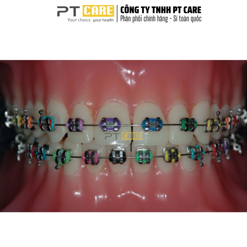 PT CARE | 10 thanh chun màu mắc cài thun đơn, tại chỗ, niềng răng, chỉnh nha