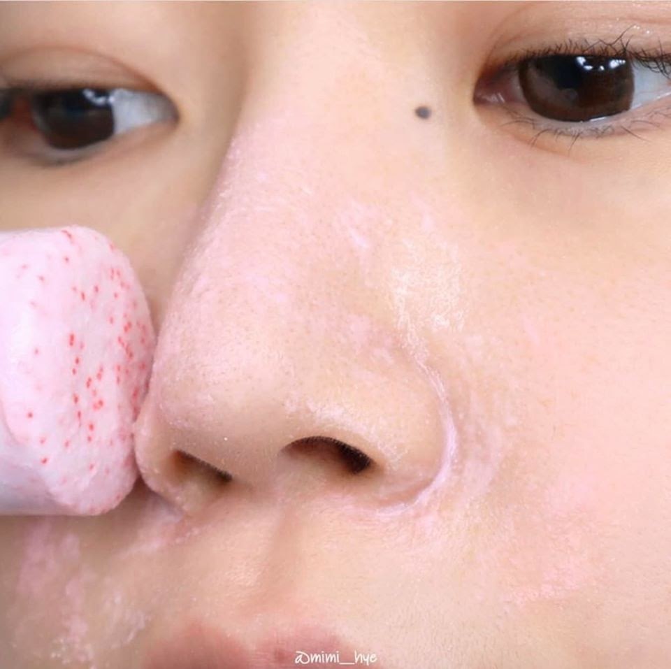 Sáp ngừa mụn So’Natural Red Peel Clear Stick Pore Blackhead & Face 23g tặng kèm mặt nạ Su:m