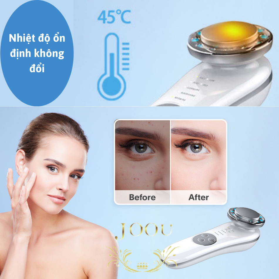 Máy Điện Di Ion Âm Dương và Ánh Sáng Sinh Học JOOU ES-1021 Máy Massage Mặt Công nghệ EMS
