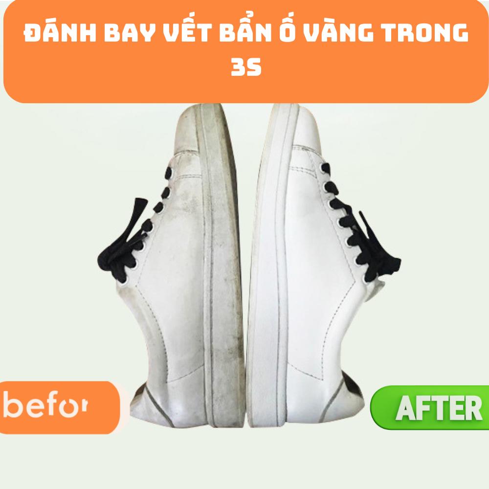 Lọ tẩy trắng giày dép, túi xách siêu sạch cực nhanh Xiaobai 100ml