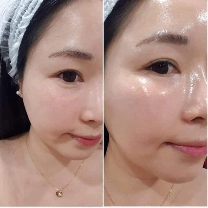 Serum HA cấp nước cho da dầu mụn Comodex Hydrate Restore Serum - Hee's Beauty Skincare
