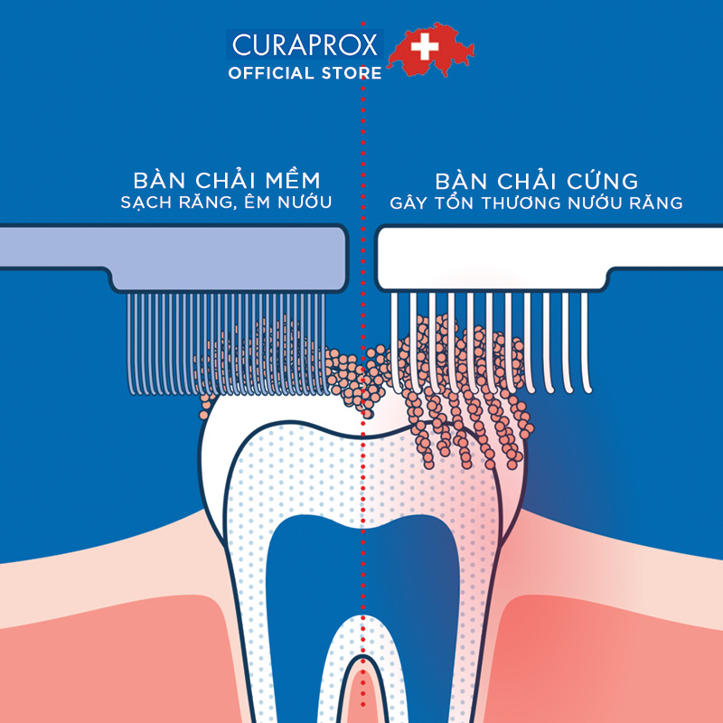 Bộ chăm sóc răng niềng Curaprox Ortho Kit (Màu sắc bàn chải bất kỳ)