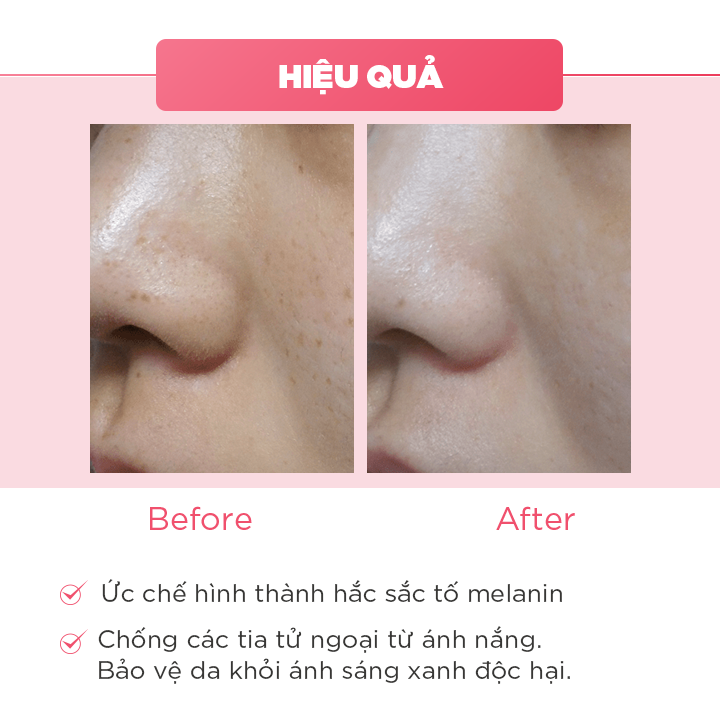 Bộ Kem Nám Tàn Nhang, Dưỡng Trắng, Mờ Thâm, Gồm Kem Oriskin Melasma Whitening Cream Và Serum Oriskin White Skin Serum