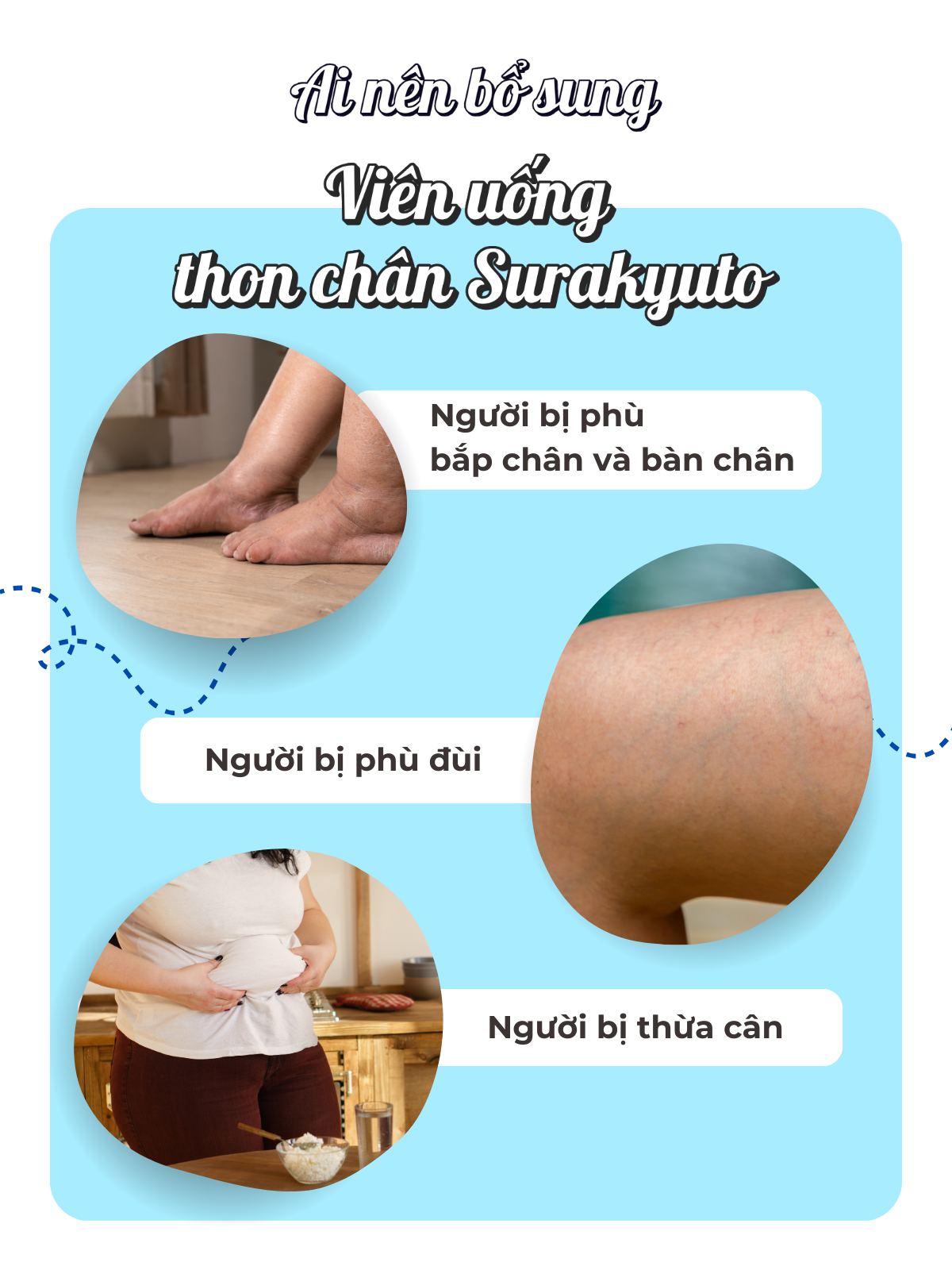 Viên Uống Hỗ Trợ Thon Gọn Chân Surakyuto Seedcoms Nhật Bản