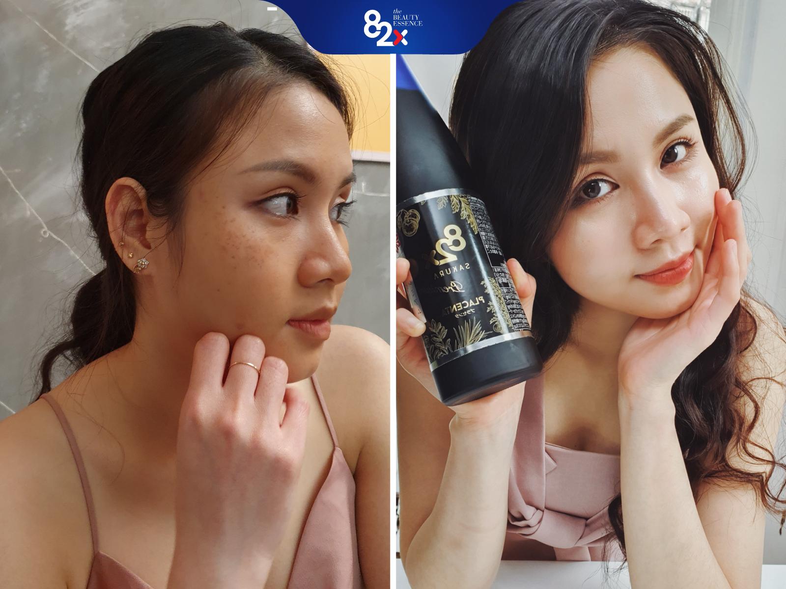 ĐẸP NÕN NÀ - DA PHỦ SƯƠNG CĂNG MƯỚT Combo 3 Chai: COLLAGEN + SAKURA COLLAGEN + SAKURA PLACENT Nước Uống Đẹp Da Nhật Bản