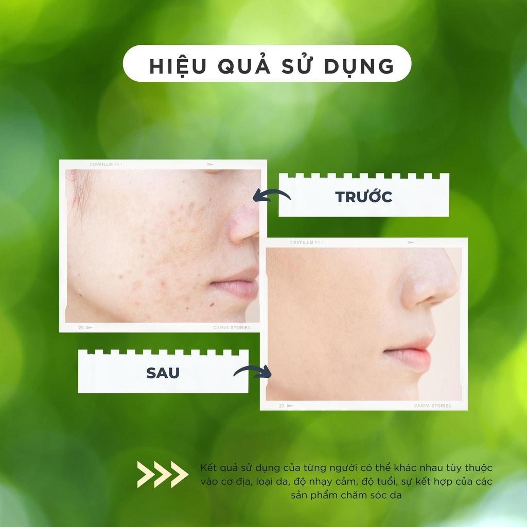 Combo Kem dưỡng và Serum dưỡng trắng, thu nhỏ lỗ chân lông CHAMIS