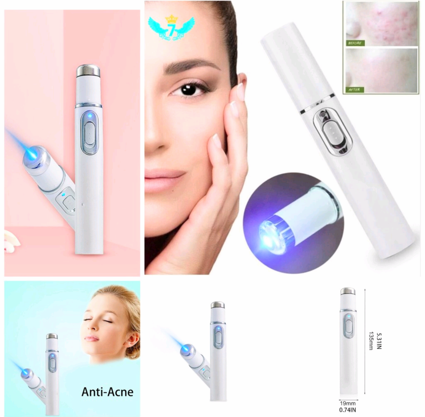 1 BÚT MÁY XÓA MỤN BẰNG TIA LASER ÁNH SÁNG XANH THÔNG MINH HIỆU QUẢ CÔNG NGHỆ MỚI SỬ DỤNG CHO NAM NỮ TIỆN DỤNG HÀNG CAO CẤP