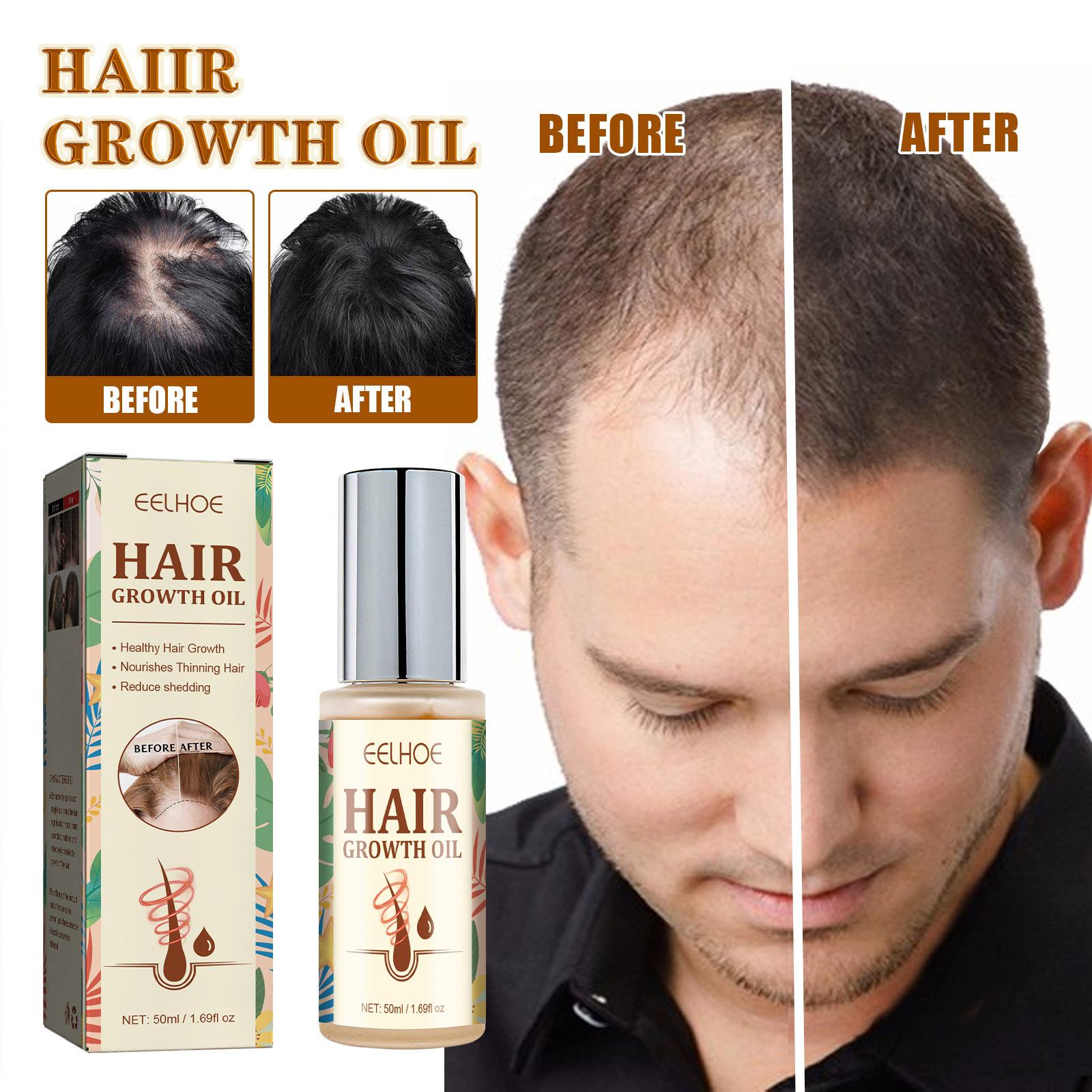 EELHOE 50ml Hair Growth Oil Nourishing Hair Anti-Breakage Repair Dry Frizzy Hair Growth Treatment Oil