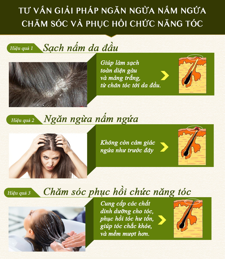 Hỗ trợ trị nấm da đầu Medi Skin Gội Thảo Dược Ngăn Ngừa Nấm Da Đầu Sạch Gàu Hiệu Quả 100gr