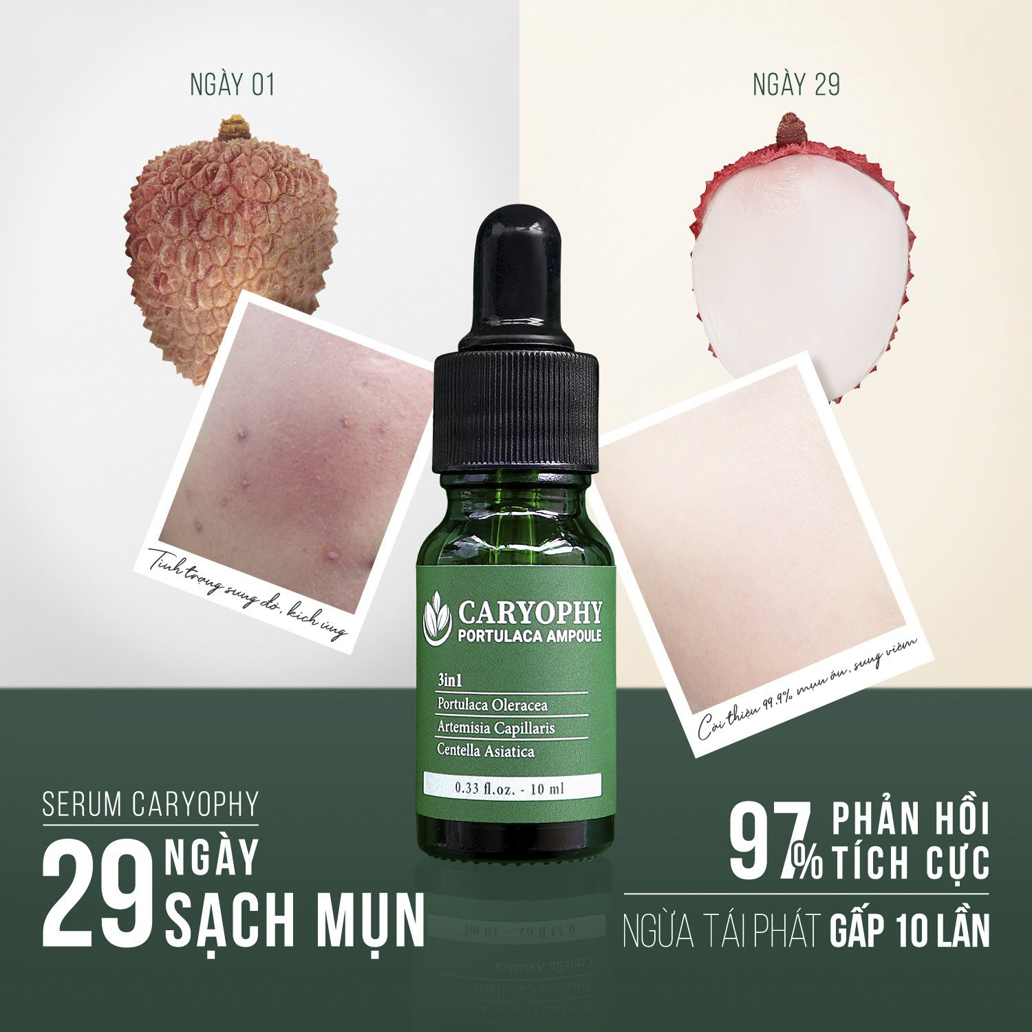 Serum Hỗ Trợ Giảm Mụn Caryophy Portulaca Ampoule 3in1 10ml