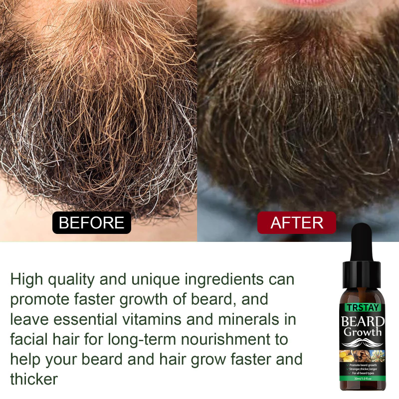 Tinh dầu tăng trưởng tóc râu Sản phẩm chống rụng tóc mới Dầu tái tạo râu tự nhiên cho nam giới Nuôi dưỡng chăm sóc râu cuộn