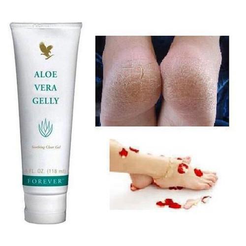 Aloe Vera Gelly Lô Hội, Gel dưỡng da thần thánh FOREVER 061flp, giảm mụn, sẹo . 118ml