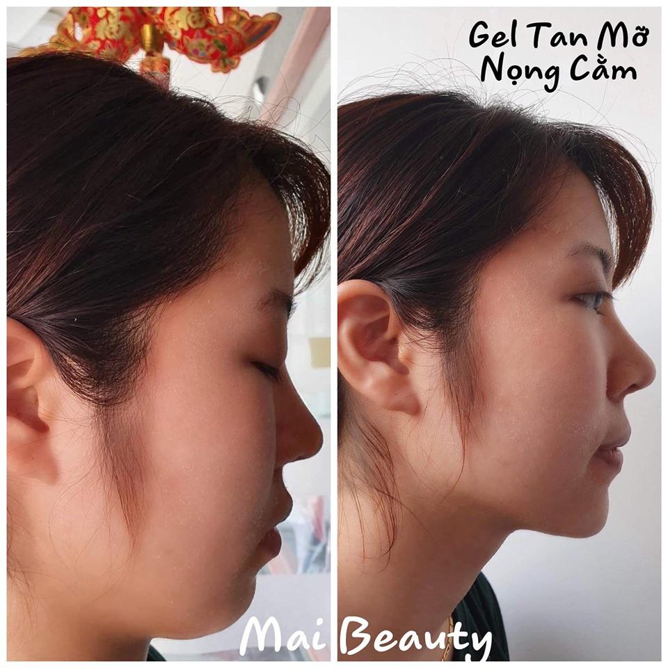 Gel Tan Mỡ Nọng Cằm Sắc Mộc Thiên - Đánh Tan Mỡ Thừa Thon Gọn Khuôn Mặt - An Toàn Hiệu Quả