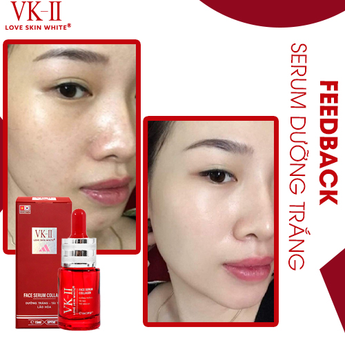 Serum Dưỡng Trắng - Tái Tạo - Trẻ Hóa Da VK II