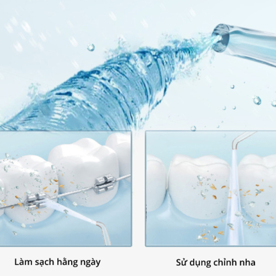 Máy tăm nước cầm tay áp suất cao, 4 đầu phun MASTER CLEAN Sạch răng 99%, Công nghệ Châu Âu.