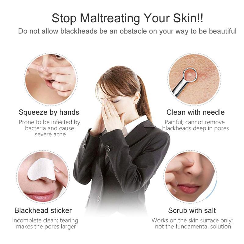 Máy Hút Mụn Đầu Đen Chân Không Chăm Sóc Da