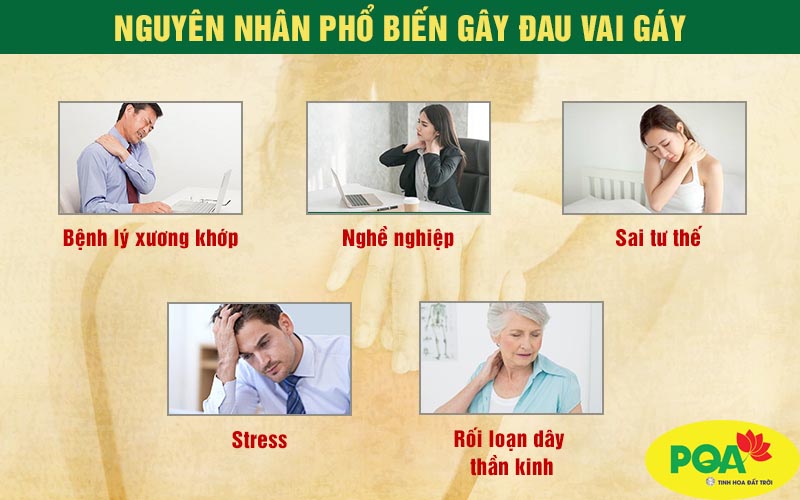 PQA Viên nang Vai Gáy là dược phẩm thảo dược hỗ trợ mạnh gân cốt, hạn chế triệu chứng đau mỏi xương khớp cho người bị đau nhức mỏi xương khớp, vai gáy, tê chân tay do phong thấp.